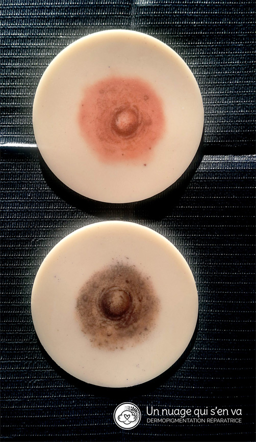 Technique de l'areole 3D